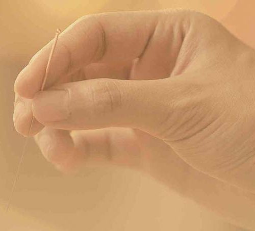 US embraces traditional Chinese medicine