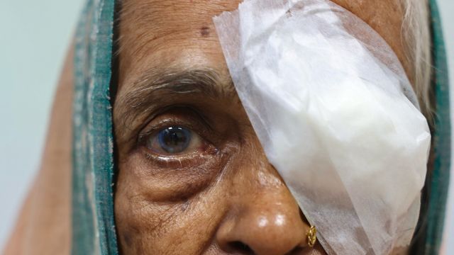 AFP__20260527__B2QX3VC__v1__MidRes__IndiaHealthPovertyGlasses.jpg