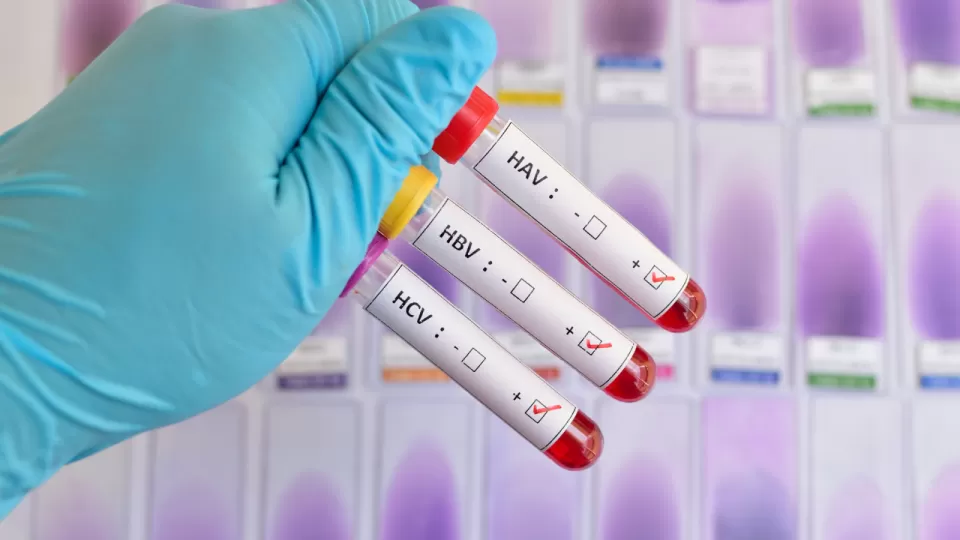 Hepatitis-blood-samples-stock.webp