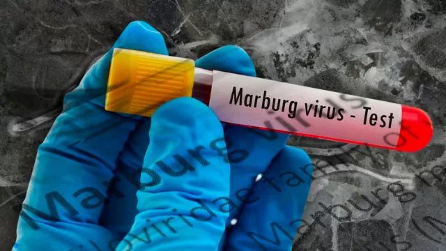 Marburg-virus.webp