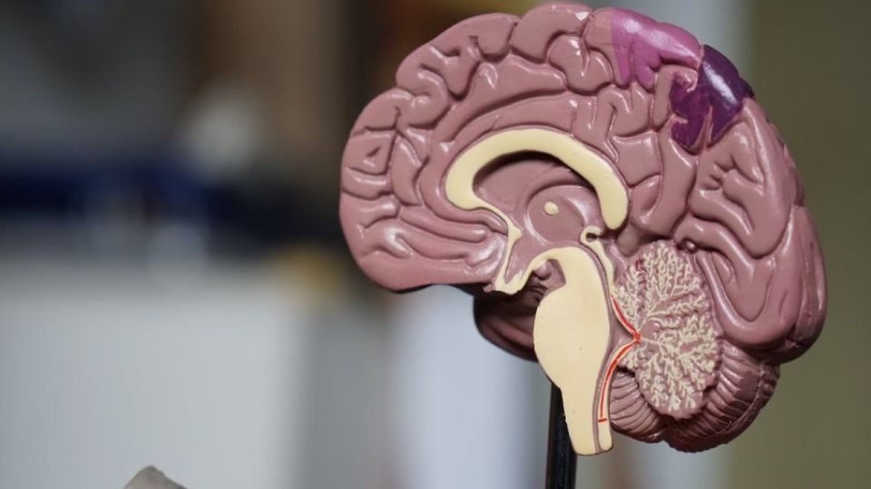 brain-health.jpg