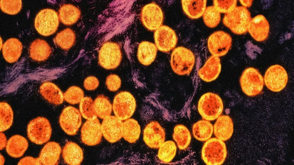 national-institute-of-allergy-and-infectious-diseases-Z86hC0Apa2g-unsplash.jpg