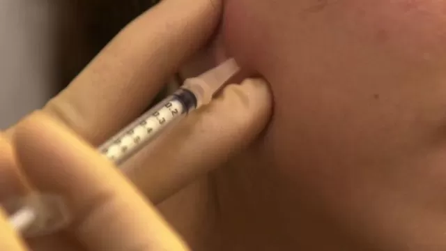 yhneedle26.webp